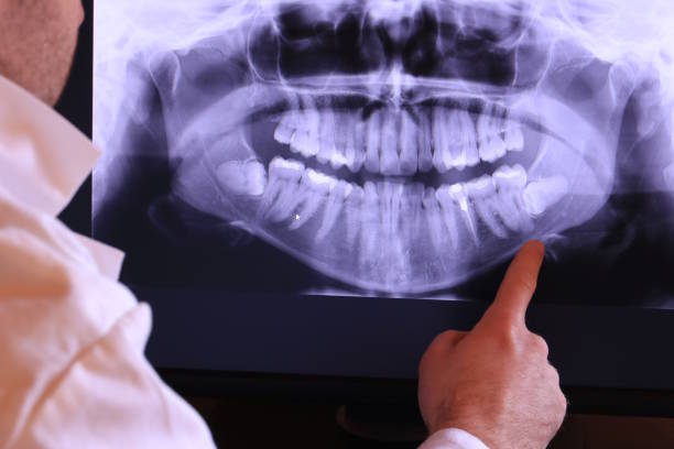 Best Walk-In Emergency Dentist in Sappington, MO